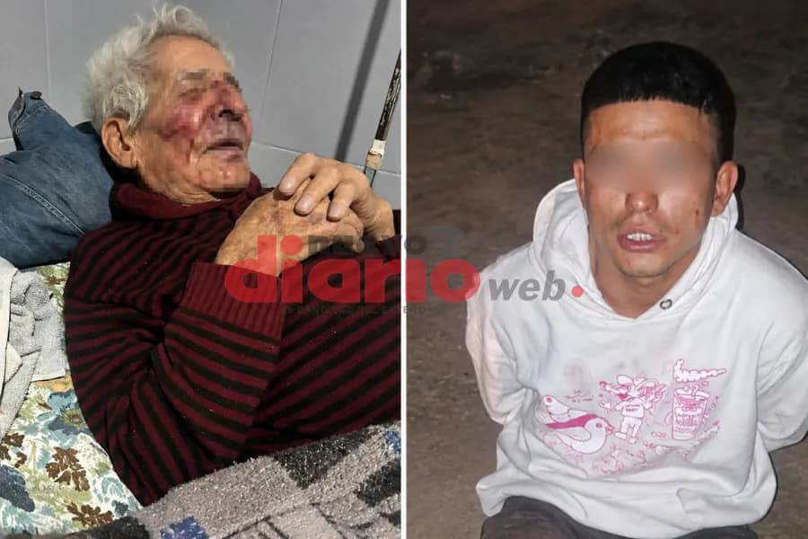 Desgarrador relato de la hija del jubilado golpeado en Las Termas: "No quiere hablar ni comer y volvió a ser internado"