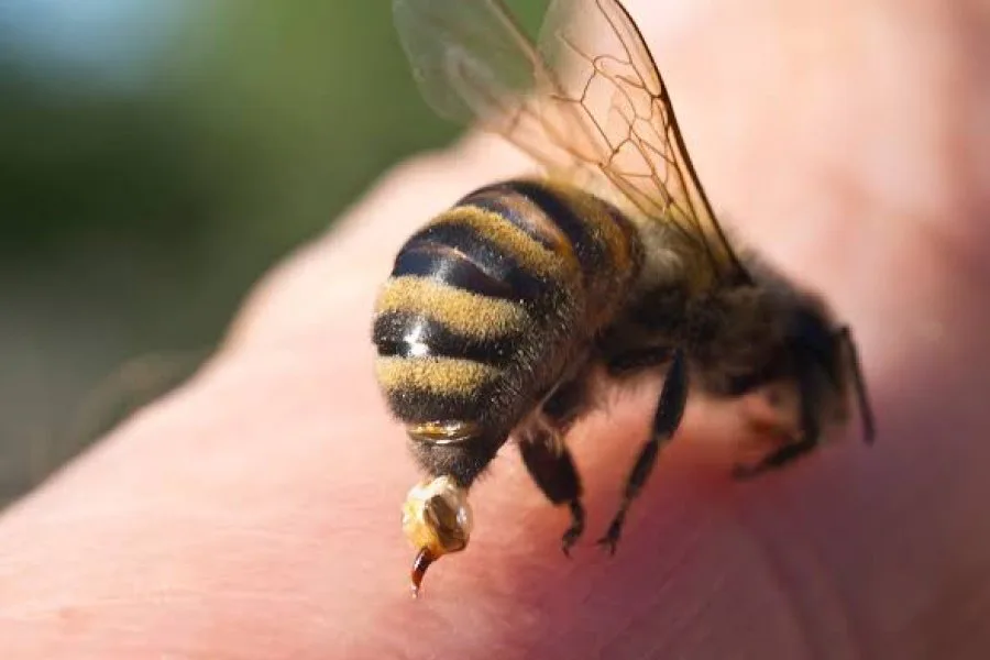 Un niño de 3 años tragó una abeja y fue derivado de urgencia tras quedar con el aguijón alojado en la garganta