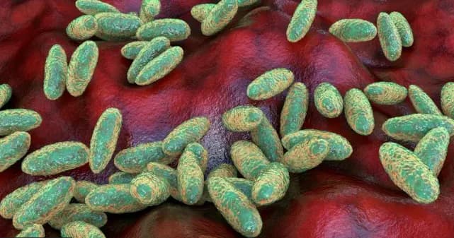 Peste neumónica: qué es, cómo se propaga y qué se investiga tras la muerte de una laboratorista en Siberia