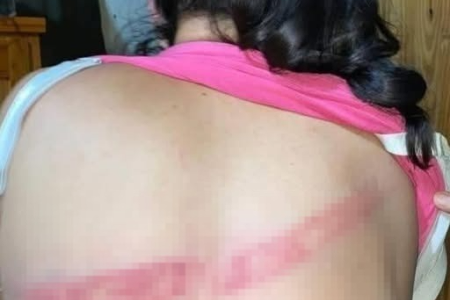 Denuncian a una mujer por presunta agresión a su hija de 12 años en Minga Guazú