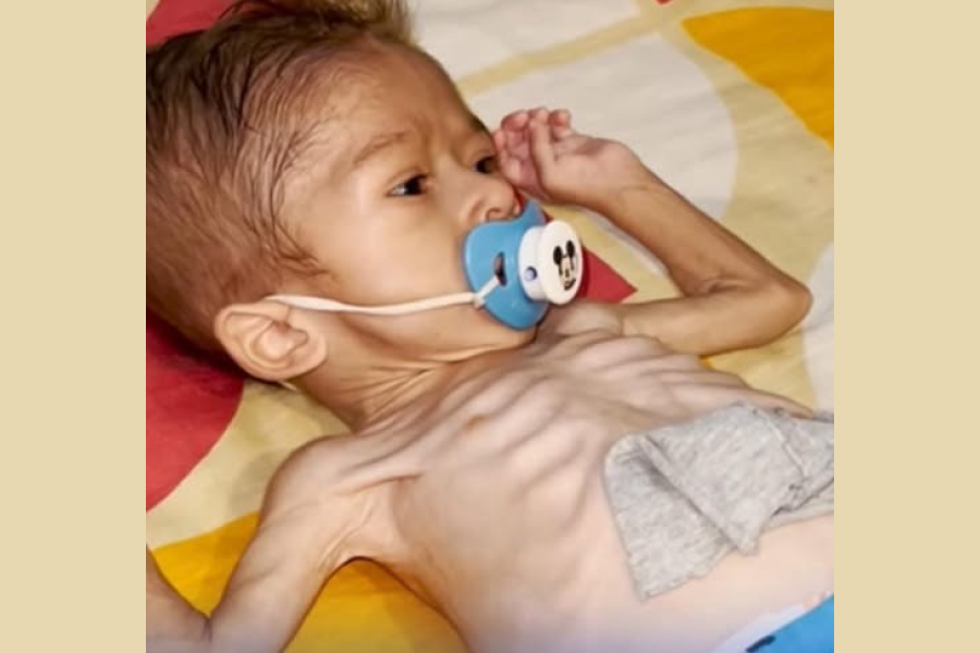 Bebé superó un tumor en la garganta y hoy está sano: la historia que conmovió a miles