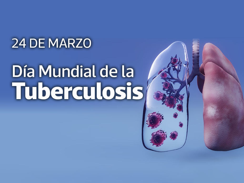 Día Mundial de la Tuberculosis: concientización sobre una enfermedad que tiene cura con tratamiento oportuno