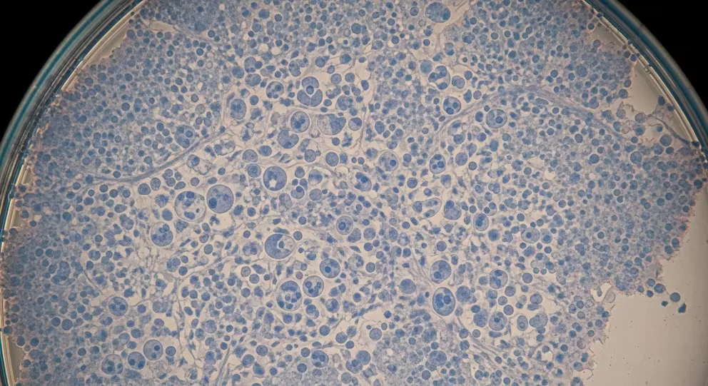 ¿Quién es la argentina investigada por el robo de virus en un laboratorio de una universidad de Brasil?