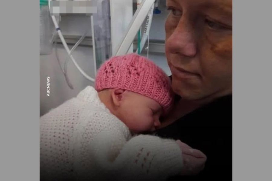 "Nunca pensé que un beso pudiera quitarle la vida": bebé de 14 días se contagió de herpes