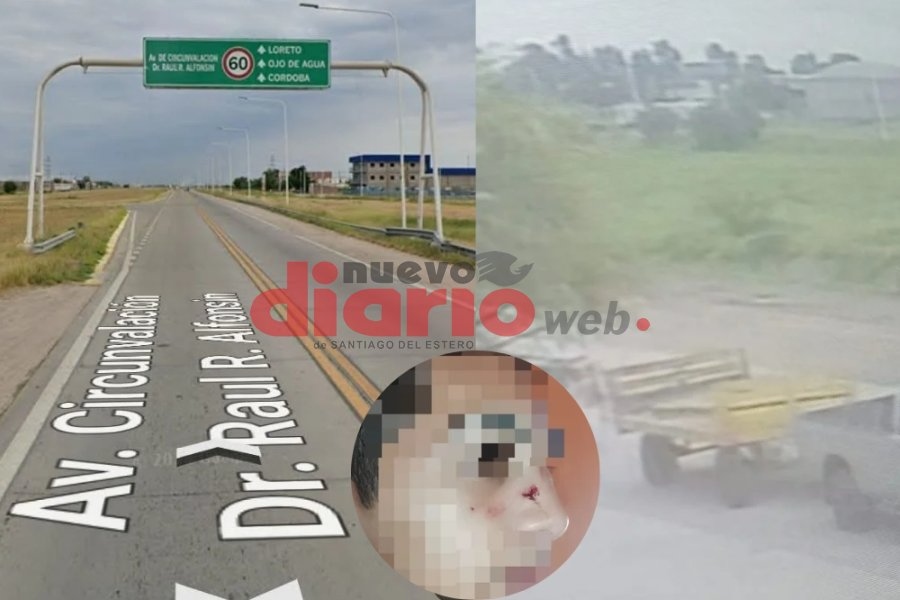 Desalmado conductor chocó a un menor en bicicleta, lo abandonó y le dejó fracturas en el rostro